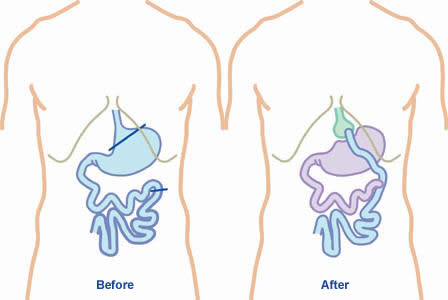 gastricbypass-dubaisurgery.org